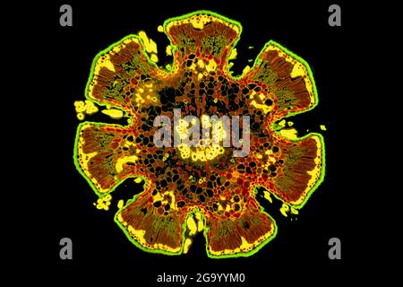 She-Oak (Casuarina), sezione trasversale attraverso lo stelo, MRI a contrasto di fase, ingrandimento x100 relativo ad una stampa di 10 cm di larghezza Foto Stock