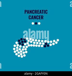 Cancro pancreatico, illustrazione concettuale Foto Stock