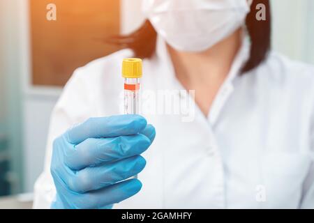Primo piano di una donna irriconoscibile, contiene in laboratorio la provetta con il campione di sangue Foto Stock