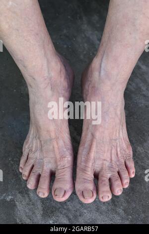 Nel sud-est asiatico, Myanmar è il germogli della visione dorsale della vecchia donna. Le pieghe della pelle, la pelle allentata e le vene mostrano invecchiamento. Isolato su fondo di cemento. Foto Stock