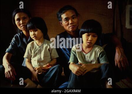 Le sorelle Lien, 8 anni, e Hien, 6 anni, sono nate dopo che il loro padre è stato spruzzato durante la guerra del Vietnam con l'agente Orange dagli aerei degli Stati Uniti. Né hanno lenti nei loro occhi. Foto Stock