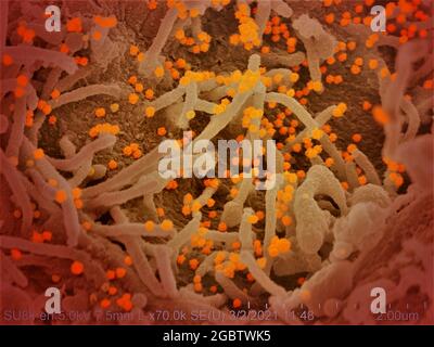 Novel Coronavirus SARS-COV-2 questa immagine al microscopio elettronico a scansione mostra SARS-COV-2 (particelle arancioni rotonde) che emergono dalla superficie di una cellula coltivata nel laboratorio. SARS-COV-2, noto anche come 2019-nCoV, è il virus che causa COVID-19. Immagine catturata e colorata presso i Rocky Mountain Laboratories di Hamilton, Montana. Credito: NIAID Foto Stock