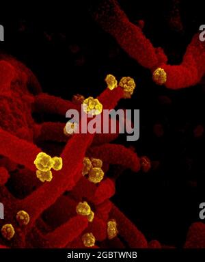 Novel Coronavirus SARS-COV-2 questa immagine al microscopio elettronico a scansione mostra SARS-COV-2 (particelle d'oro rotonde) che emergono dalla superficie di una cellula coltivata nel laboratorio. SARS-COV-2, noto anche come 2019-nCoV, è il virus che causa COVID-19. Immagine catturata e colorata presso i Rocky Mountain Laboratories di Hamilton, Montana. Credito: NIAID Foto Stock