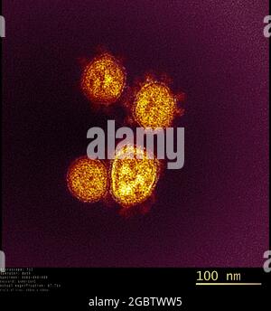 Novel Coronavirus SARS-COV-2 questa immagine al microscopio elettronico a trasmissione mostra SARS-COV-2, noto anche come 2019-nCoV, il virus che causa COVID-19. Le particelle di virus sono mostrate emergere dalla superficie di una cellula coltivata nel laboratorio. I picchi sul bordo esterno delle particelle di virus danno il loro nome, corona-simile a coronavirus. Immagine catturata e colorata presso i Rocky Mountain Laboratories di Hamilton, Montana. Credito: NIAID Foto Stock