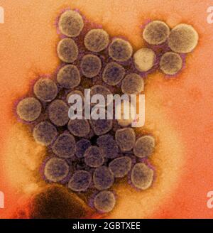 Micrografia elettronica di trasmissione di un ceppo variante di particelle di virus SARS-COV-2 (UK B.1.1.7), isolato da un campione di paziente e coltivato in coltura cellulare. Immagine catturata presso la NIAID Integrated Research Facility (IRF) di Fort Detrick, Maryland. Credito: NIAID Foto Stock