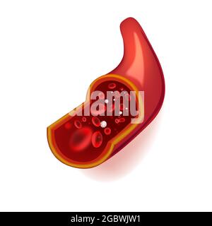 Illustrazione vettoriale del vaso sanguigno umano nella sezione con globuli rossi. Illustrazione Vettoriale