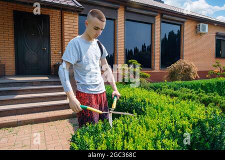 L'uomo con un braccio amputato e una protesi sta rifilando i cespugli in un giardino Foto Stock