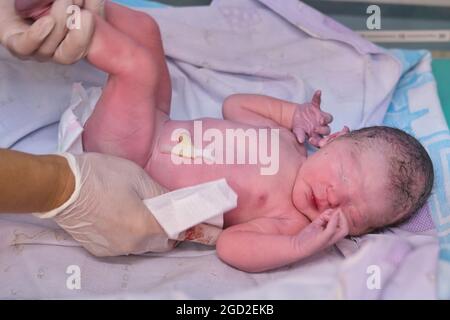 Nappy medicazione un bambino neonato da un medico immediatamente dopo il parto Foto Stock