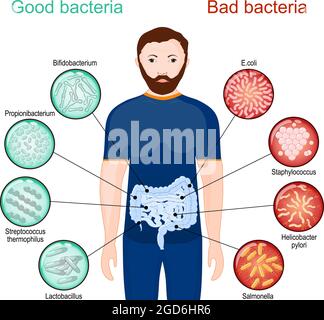 Batteri buoni e cattivi. Poster sui probiotici e la salute degli intestini. Budello microbiota, o flora intestinale. Illustrazione vettoriale Illustrazione Vettoriale
