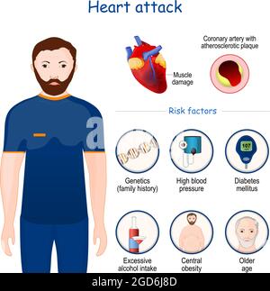 Infarto. Segni, sintomi e fattori di rischio. Infografica. Sezione trasversale dell'arteria coronaria con placca aterosclerotica Illustrazione Vettoriale