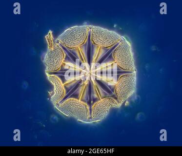 Fossile diatom, Oamaru, Nuova Zelanda, Jacksons, fotomicrografia Foto Stock