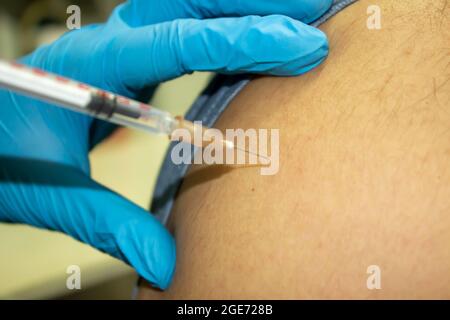 Un'infermiera che inietta il vaccino alla spalla. Covid - 19 evento di vaccinazione. Una foto in primo piano e messa a fuoco selettiva di syring e mano infermiere. una medica Foto Stock