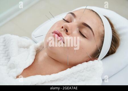 Giovane donna che ha una terapia di agopuntura sul suo viso in salone termale. Medicina alternativa e concetto di terapia Foto Stock