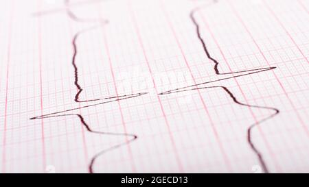 frequenza cardiaca su primo piano di cardiogramma cartaceo. Foto Stock