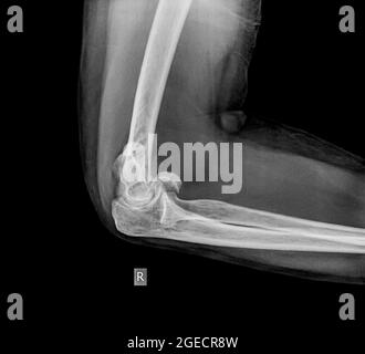 Blocco Di Distribuzione Dell'aria Del Collettore Pneumatico A Forma Di - Foto 7