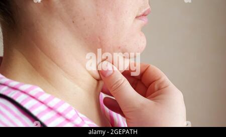 La donna irriconoscibile tocca il doppio mento Foto Stock