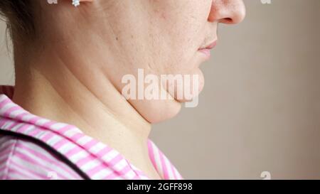 Tocchi di donna irriconoscibili e massaggi doppio mento Foto Stock