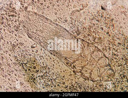 Foto al microscopio ad alta risoluzione Demodex o acari facciali Foto Stock