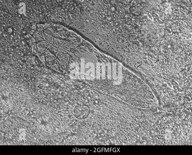 Foto al microscopio ad alta risoluzione Demodex o acari facciali Foto Stock