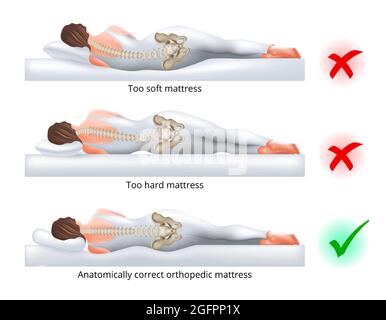 Scelta di un materasso ortopedico per il sonno - posizione del sonno corretta e errata sul lato, illustrazione vettoriale. Illustrazione Vettoriale