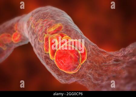 Coagulo di sangue, illustrazione. Foto Stock