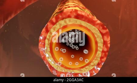 Illustrazione 3d dei sintomi dell'asma, trattamento, bronchiolo, rendering 3d Foto Stock