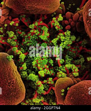 Micrografia elettronica a scansione colorata di una cellula apoptotica (rossa) fortemente infettata con particelle di virus SARS-COV-2 (verde), isolate da un campione di paziente. Foto Stock