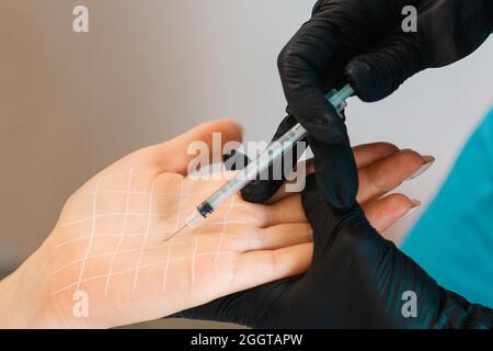 Procedura in salone di bellezza. Il medico effettua iniezioni di tossina botulinica sul palmo femminile del cliente contro l'iperidrosi. Primo piano. Concetto di cosmetolo Foto Stock