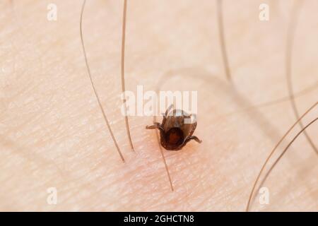 Spuntare con la testa che si attacca nella pelle umana Foto Stock