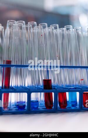 Provetta per analisi mediche con sangue in piedi sul tavolo durante l'esame molecolare chimico in laboratorio ospedaliero di microbiologia. Infezione genetica biochimica. Trattamento sanitario Foto Stock