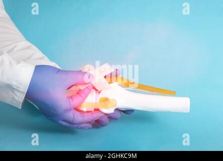 Dottore traumatologo ortopedist colla un cerotto medico sul mockup delle articolazioni del ginocchio su sfondo blu. Il concetto di trattamento delle ginocchia per l'artrosi A. Foto Stock