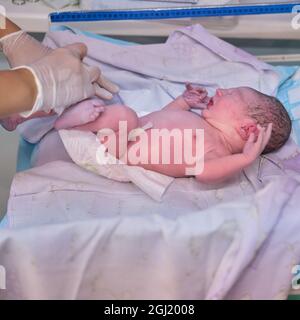 Medicazione pannolino un neonato da un medico immediatamente dopo il parto Foto Stock