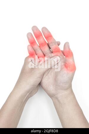 Infiammazione alle articolazioni delle dita del giovane asiatico. Concetto di dolore alle articolazioni della mano. Isolato su bianco. Foto Stock