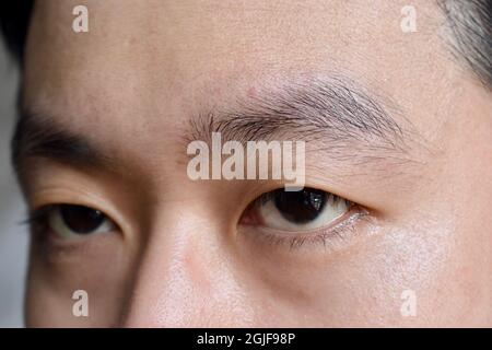 L'invecchiamento della pelle si piega o la pelle si piega o si grinza sul viso soprattutto intorno agli occhi del sud-est asiatico, uomo cinese. Primo piano. Foto Stock
