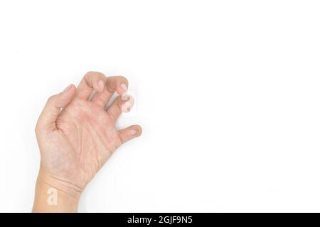 Spasmo muscolare della mano nel giovane asiatico. Deformità unilaterale della mano. Flessione anomala delle dita. Isolato su sfondo bianco. Spazio di testo presente. Foto Stock