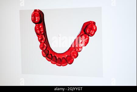 Report in un laboratorio di protesi dentaria che utilizza un sistema CAD/CAM (computer Aided Design Manufacturing) ed è dotato di un CAD/CA Zirkonzahn Foto Stock