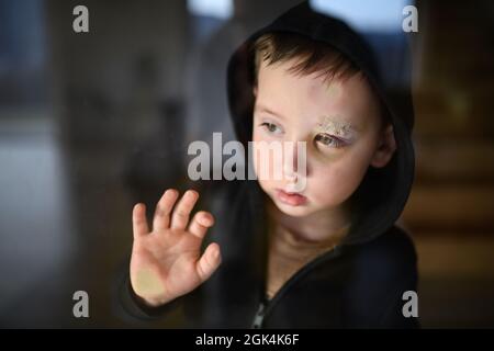 Povero ragazzo triste con sopracciglia tagliata in piedi in casa, concetto di povertà. Foto Stock