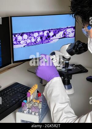 Assistente di laboratorio che fa la ricerca con un'immagine del calcolatore di treponema pallido. Foto Stock