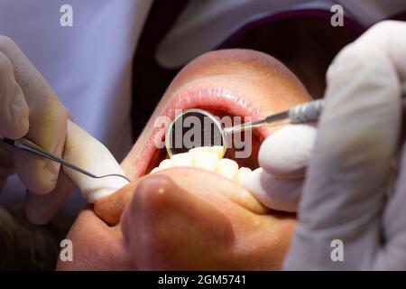 Dentista con guanti in lattice con specchio piccolo e strumento ortodontico che controlla i denti della paziente con bocca aperta. Cura orale, clinica dentale Foto Stock