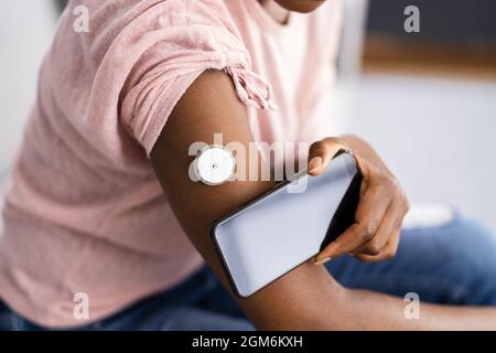 Donna che verifica il livello di glucosio con il monitoraggio continuo del glucosio su dispositivi mobili Telefono Foto Stock