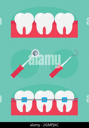 set denti e dentini Illustrazione Vettoriale