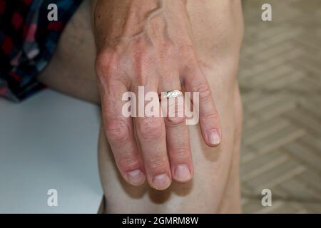 Primo piano di una mano di una donna anziana che mostra rughe e linee. Un anello di nozze sul dito. Foto Stock