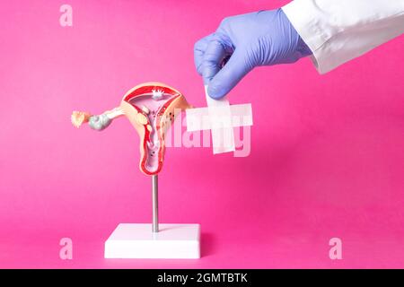 Medico che tiene un cerotto medico vicino al layout del sistema riproduttivo femminile su uno sfondo rosa. Concetto di interventi chirurgici per le donne, int Foto Stock