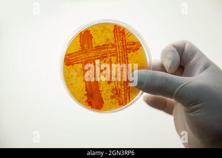 Lo scienziato tiene in mano un piatto di Petri con aree marcate di crescita batterica. Piastra Petri con tenuta di mano con guanti e coltura batterica Foto Stock