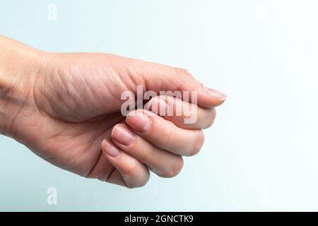 Primo piano di una mano caucasica femminile con unghie naturali non lucidate, cuticola sopravfatta su sfondo bianco, vista dall'alto, spazio di copia. Unghie naturali concep Foto Stock