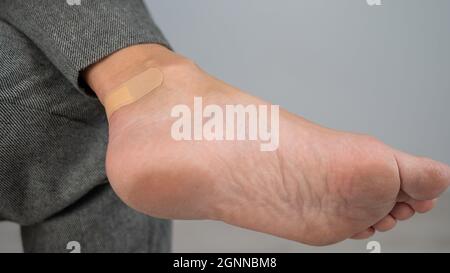 Una donna sigilla un granoturco sulla gamba con un gesso. La ragazza le sfregò la gamba con scarpe scomode. Foto Stock