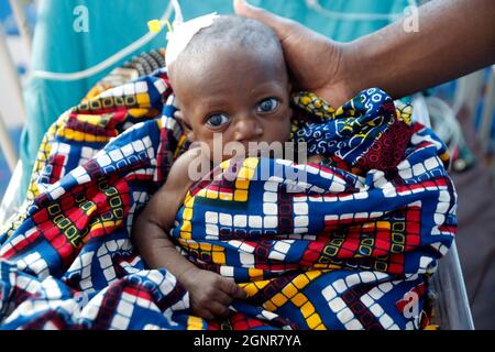 Ospedale africano. Reparto pediatrico. Bambino in unità di terapia intensiva. Benin. Foto Stock