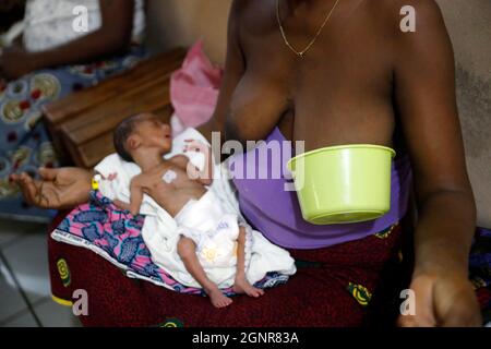 Ospedale africano. Reparto di maternità. Neonato prematuro. Benin. Foto Stock