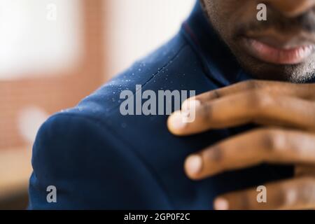 Uomo spazzolando Dandruff da vestito sporco. Prurito alla testa e ai capelli Foto Stock