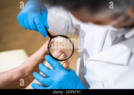 Problema di coda di rondine. Controllo del piede del paziente infetto Foto Stock